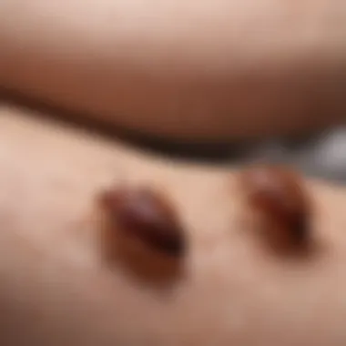 Skin reactions from bed bug bites